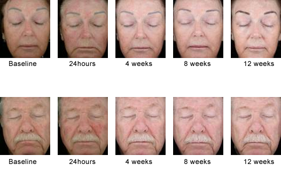 Kerastick-Before-and-After.png